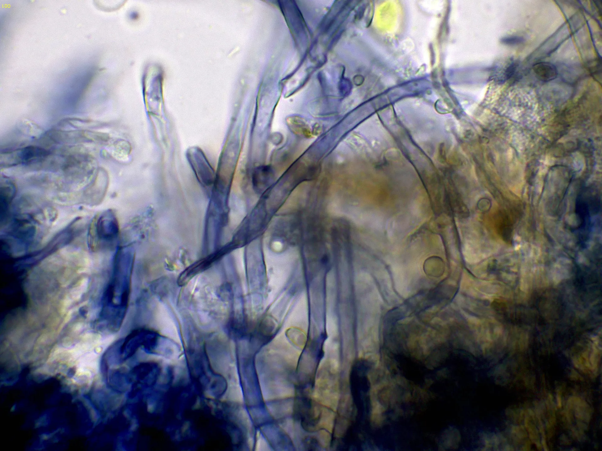 Microscopía de Terana coerulea - 5 - Hifas subiculares agua-001